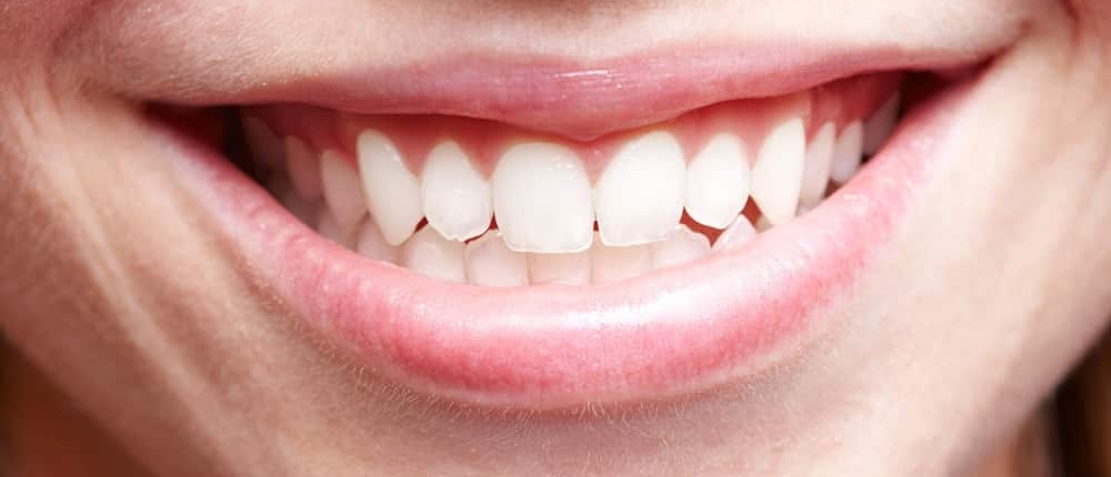 Gezonde_mond_tandvlees